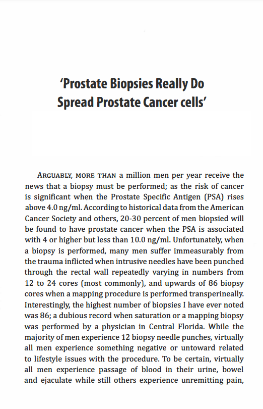 Prostate Biopsies Really Do Spread Prostate Cancer Cells